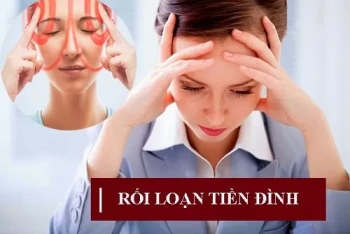 Rối Loạn Tiền Đình Có Thể Điều Trị Khỏi Hẳn Được Không?